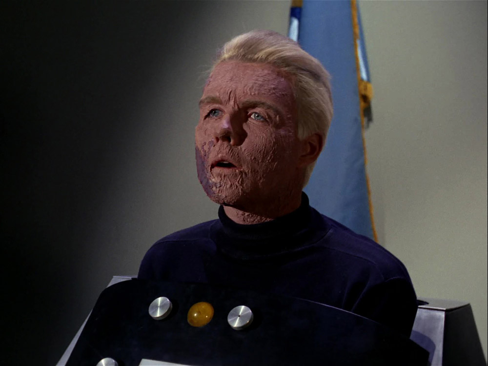 Christopher Pike suffering the effects of exposure to delta rays (TOS16)
